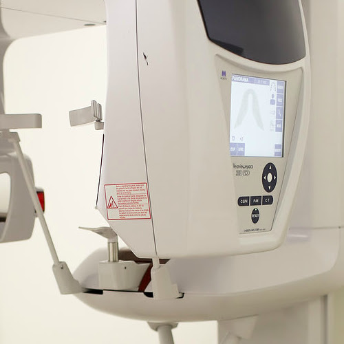 Our CBCT machine allows us to take 3d images of your tooth before your root canal